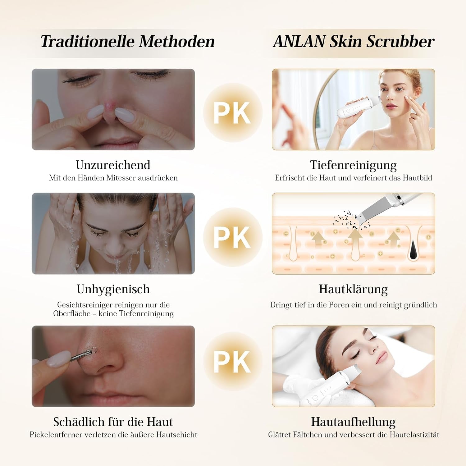 ANLAN Peeling Ultrasónico Facial Skin Scrubber Exfoliación Limpiador De Poros Para Limpieza Y Cuidado (Blanco)