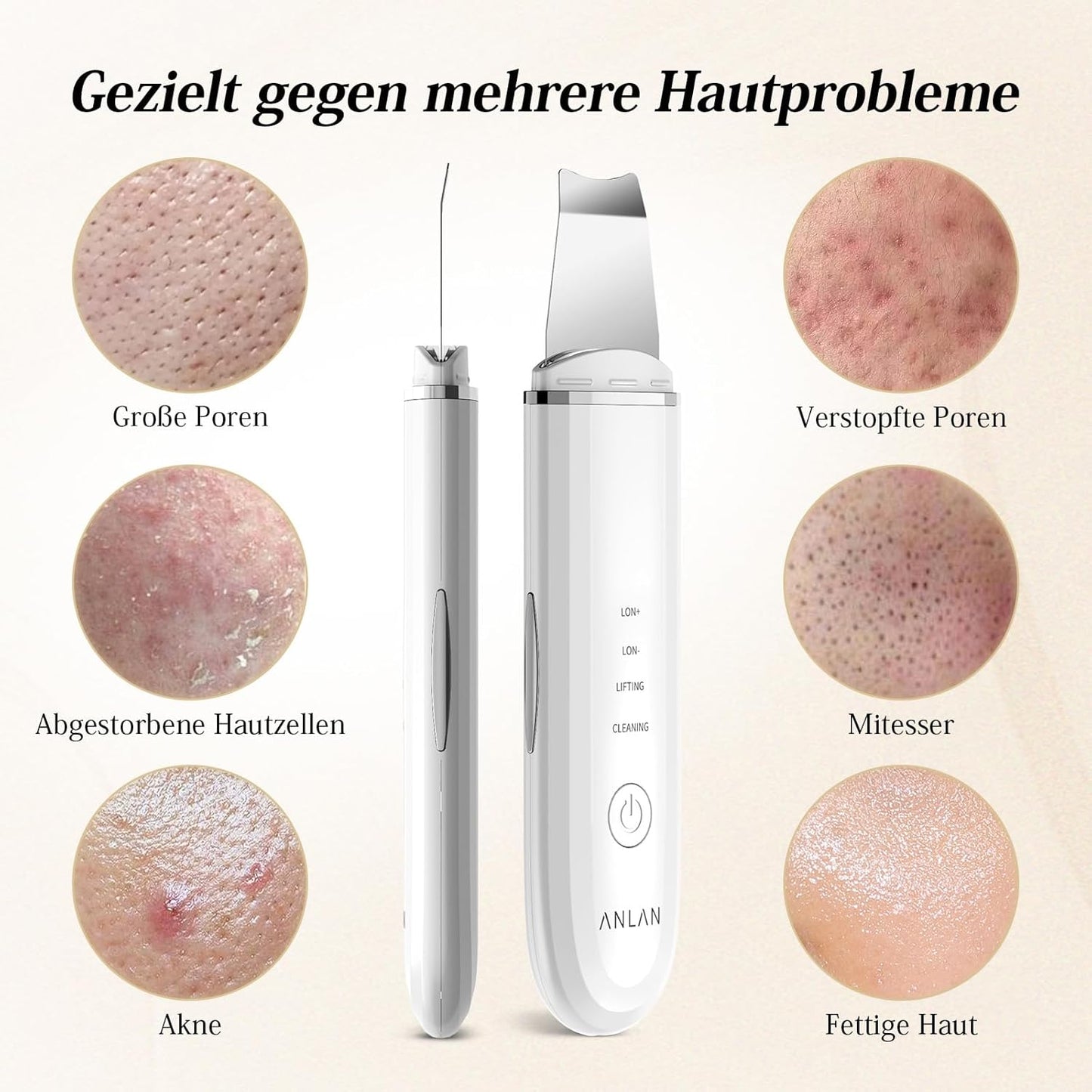 ANLAN Peeling Ultrasónico Facial Skin Scrubber Exfoliación Limpiador De Poros Para Limpieza Y Cuidado (Blanco)