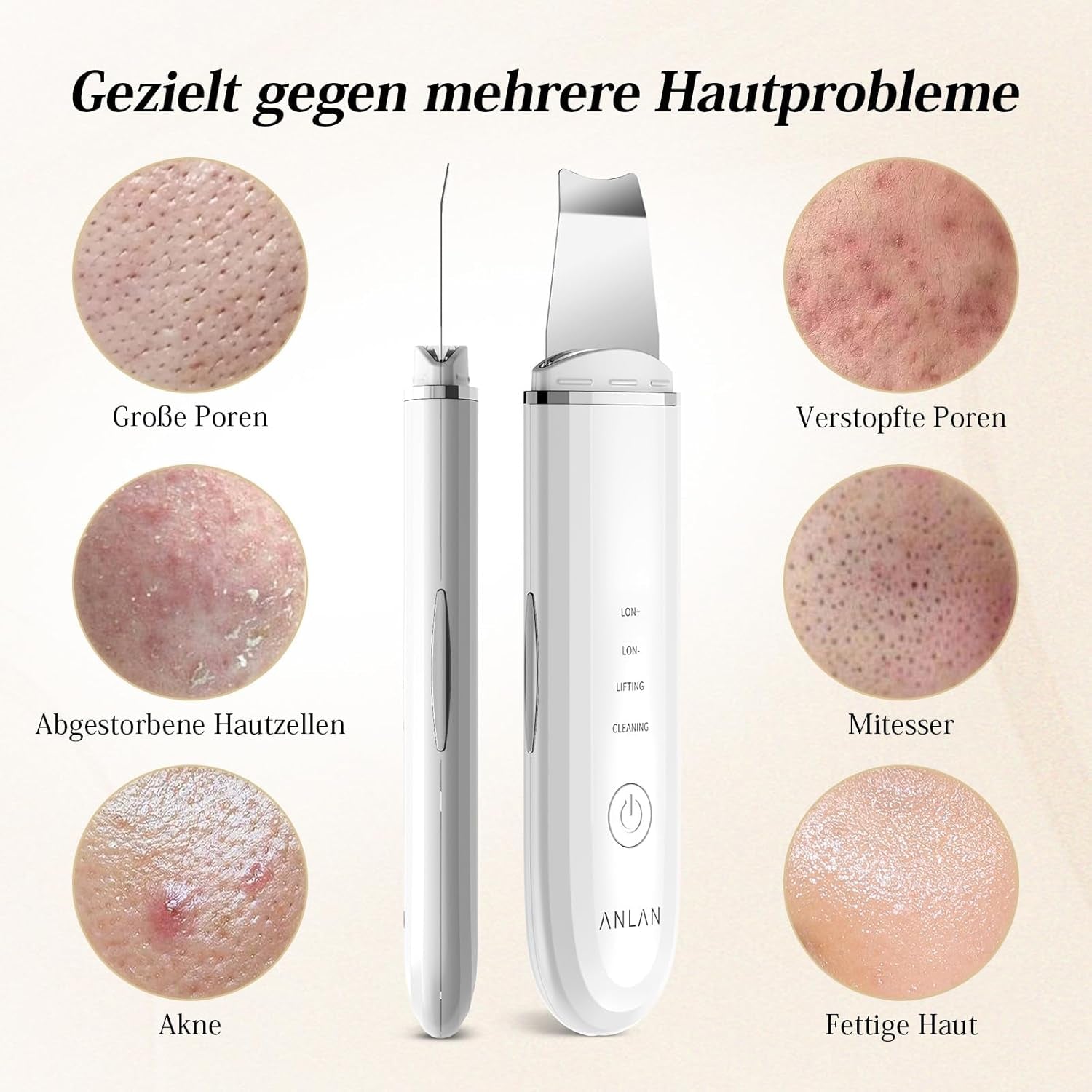 ANLAN Peeling Ultrasónico Facial Skin Scrubber Exfoliación Limpiador De Poros Para Limpieza Y Cuidado (Blanco)